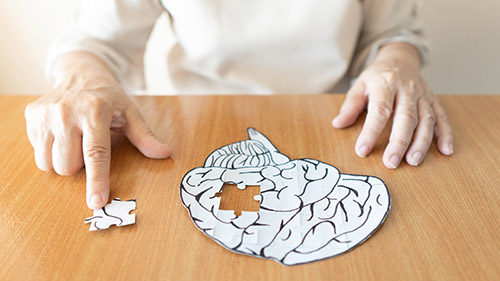 The Three Major Alzheimer’s Disease Stages with Brief Description - Carrollton, GA